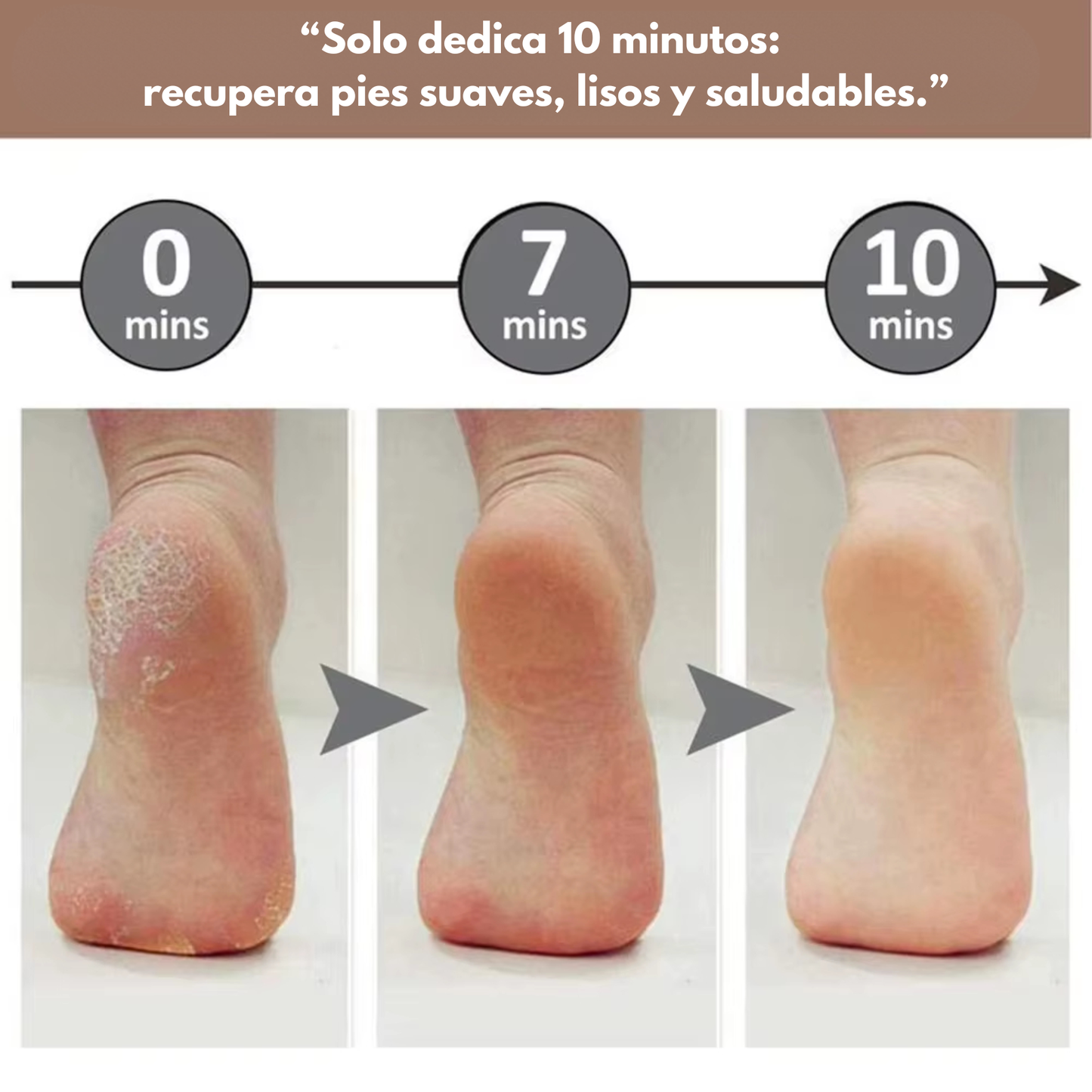 VelvetFeet-Lima Eléctrica para-Pies™
